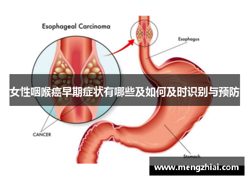 女性咽喉癌早期症状有哪些及如何及时识别与预防